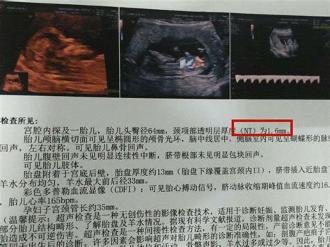 怀孕3月，B超单上这两个数据看懂了，就能知道胎儿的“小秘密”