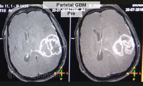 Dr. Adam's NeuroConsult