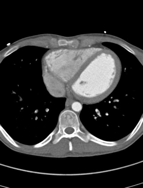 Switch Procedure 的图像结果