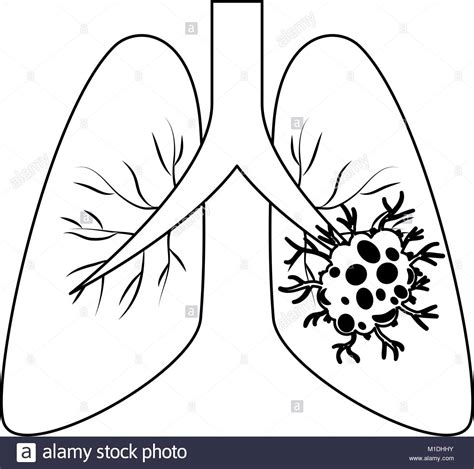 Lung Cancer Drawing at GetDrawings | Free download