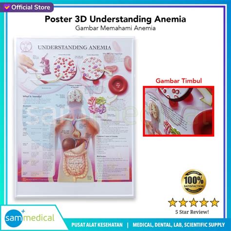 Jual Poster 3D Understanding Anemia / Gambar Memahami Anemia BS 181 ...