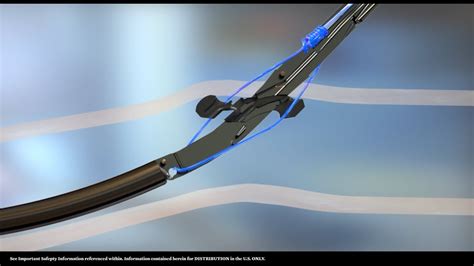 Image result for Perclose Device Tutorial