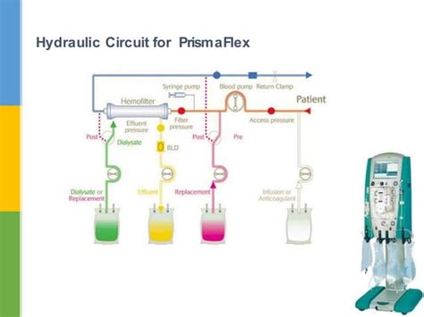CRRT Recirculation 的图像结果