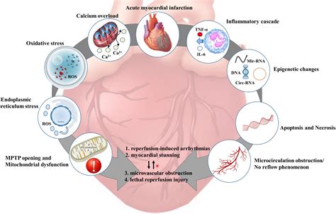 Frontiers | Preclinical multi-target strategies for myocardial ischemia-reperfusion injury