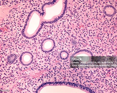 Image result for Endometrium Cell