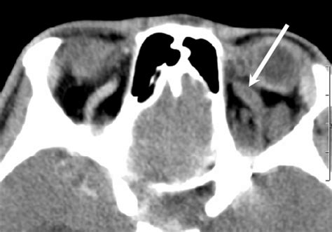 Image result for Scanner Cerebral Avec Injection Diode