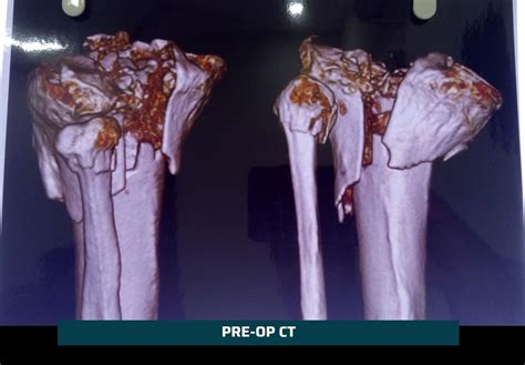 Polytrauma Surgeon in Ahmedabad | Dr. Rachit Sheth