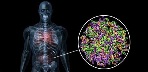 The Bug Hunters and the Microbiome - The Wire