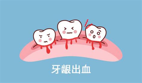 我怎么老是牙龈发炎，还出血？ 专题专栏