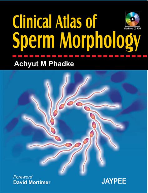 CLINICAL ATLAS OF SPERM MORPHOLOGY WITH PHOTO CD ROM 1/E, 2007, ACHYUT ...