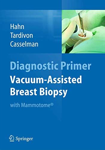 Buy Vacuum-Assisted Biopsy with Mammotome(R) (Diagnostic Primer ...