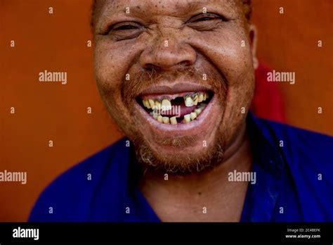 Image result for Toothless Man Laughing