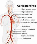 Proximal Aorta Anatomy | Aortic Arch Diagram - HSPEFC