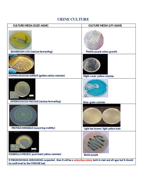 Urine Culture - Microbiology imp - URINE CULTURE CULTURE MEDIA (CLED AGAR) CULTURE MEDIA (UTI ...