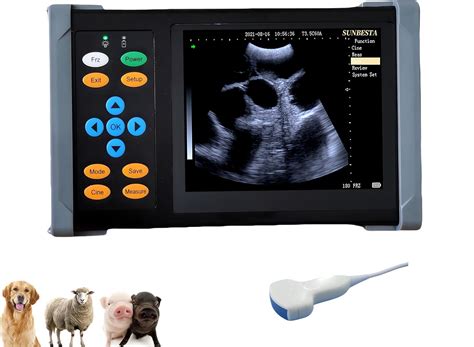 Amazon.com: SUNBESTA A20 Portable Ultrasound Machine for Pregnancy, at Home Ultrasound Machine ...
