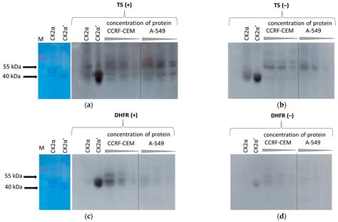 Phosphorylation of Thymidylate Synthase and Dihydrofolate Reductase in ...