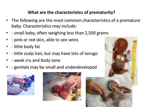 Physical Characteristics Of Premature Babies In Adulthood