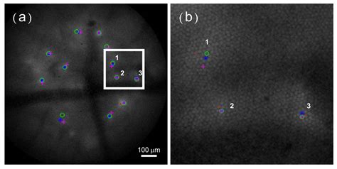 Image Analysis of Dynamic Brain Activity Based on Gray Distance ...