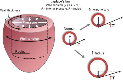 Pathophysiology of heart failure and an overview of therapies ...