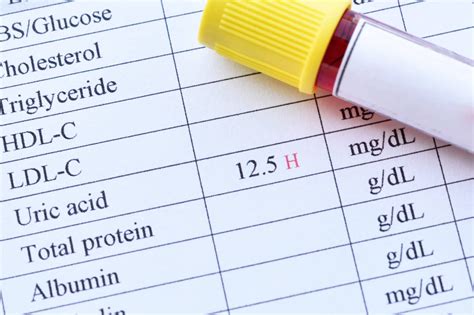 Maintenance of normal serum uric acid levels may improve health ...