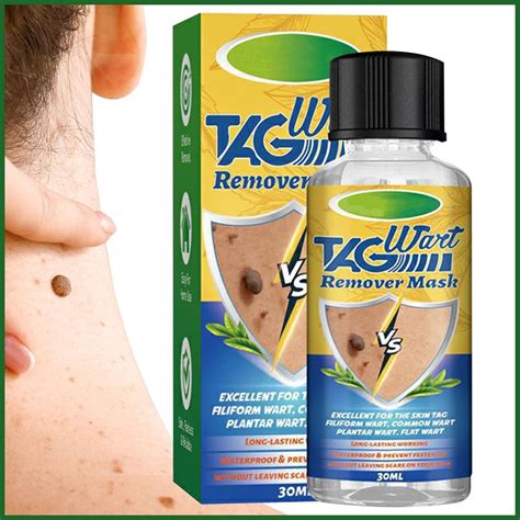 Removedor De Verrugas Líquido Plantar Y Genital Verruga Tratar Etiquetas De La Piel Ataques ...