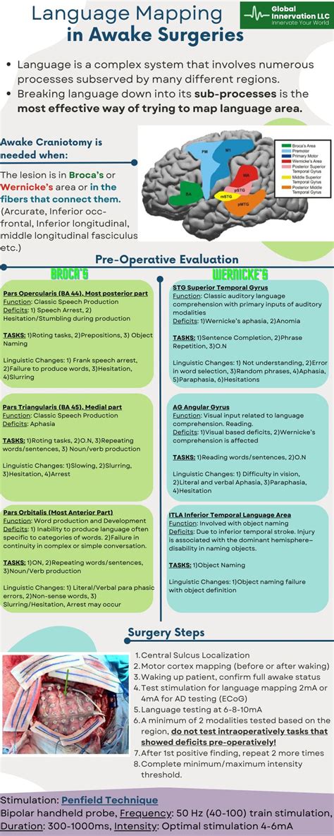 Image result for Language Mapping Awake