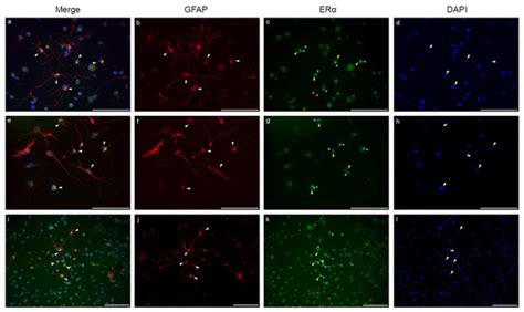Immunofluorescent Evidence for Nuclear Localization of Aromatase in ...