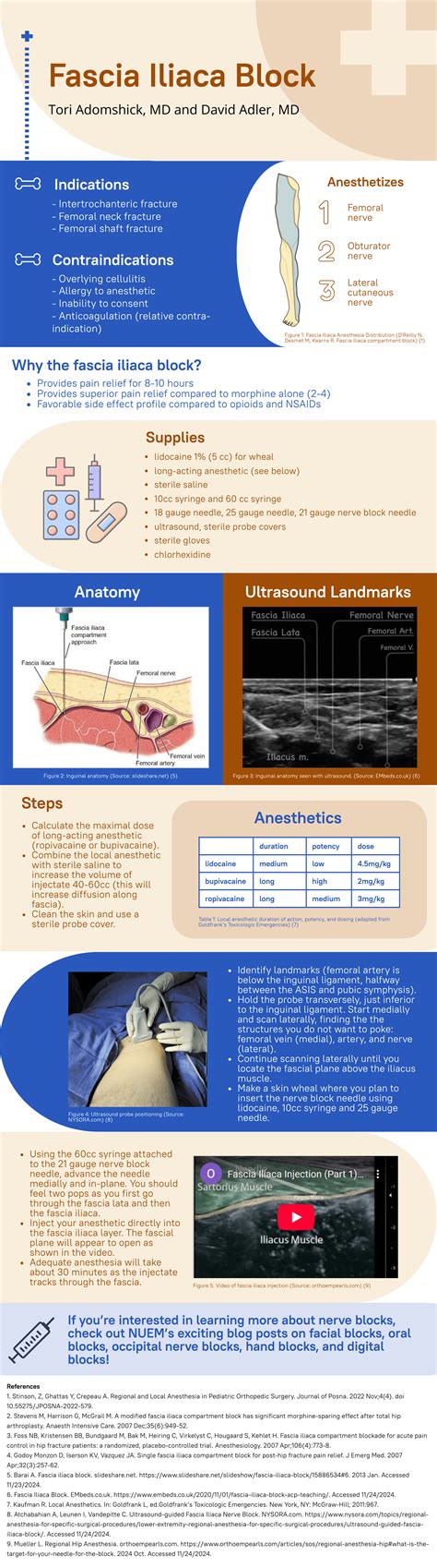 Fascia Iliaca Block — NUEM Blog