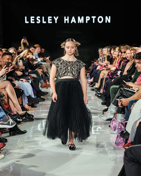 Down Syndrome Celebrities 60 Photos - Moonagedaydream.film