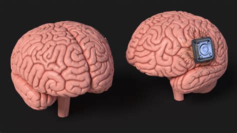 Human Brain With Implanted Microchip for 3D Print 3D model | 3D Molier ...