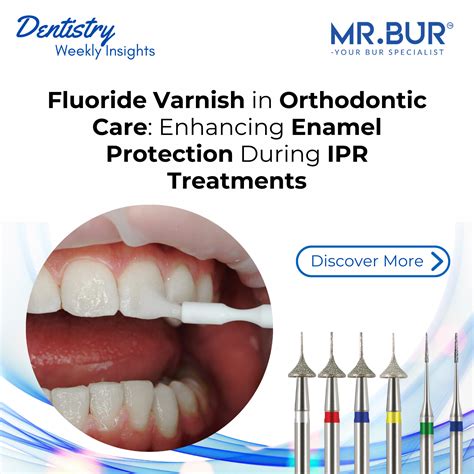 Fluoride Varnish in Orthodontics: Protecting Enamel During IPR MR. BUR AUSTRALIA – Mr Bur