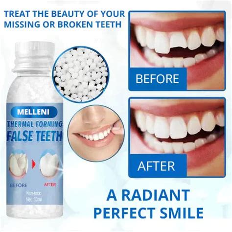 🔥Hot Sale 49% OFF🔥Temporary Tooth Gap Repair Kit – TEWUE