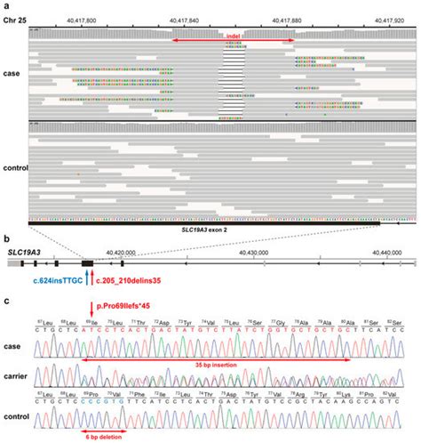 SLC19A3 Loss-of-Function Variant in Yorkshire Terriers with Leigh-Like ...
