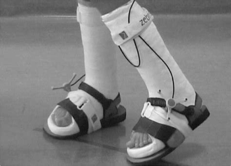 Toe Walking - Causes, Idiopathic Toe Walking, How To Stop Toe Walking