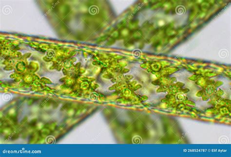 Spirogyra Under Microscope
