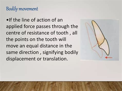 Biomechanics in Orthodontic tooth movements | PPTX