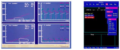 CARDIOSIM©: The First Italian Software Platform for Simulation of the ...