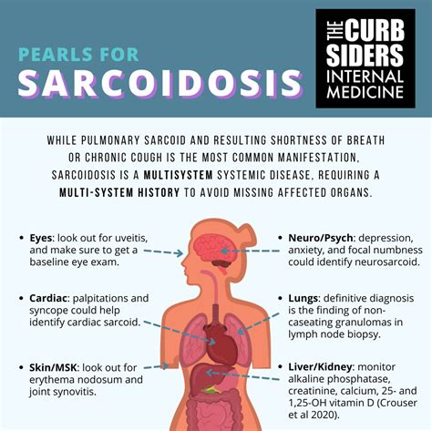 Cardiac and pulmonary sarcoidosis