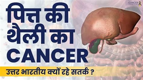 Image result for Gallbladder Cancer