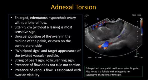 Ultrasound Evaluation of Pelvic Emergencies - A Comprehensive Overview