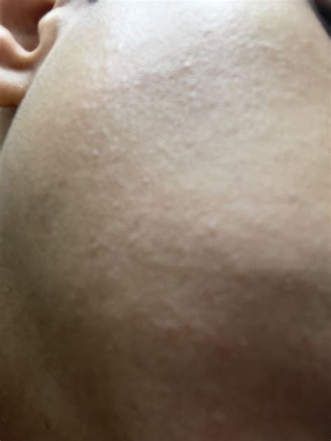 Image result for Condition Cheeks