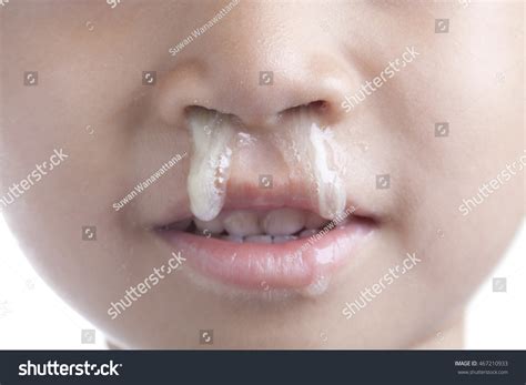 Mustard Yellow Mucus From Nose at Betty Mcclusky blog