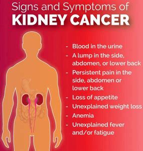 Human Kidney Anatomy Poster for Hospital Poster Nursing Home Poster ...
