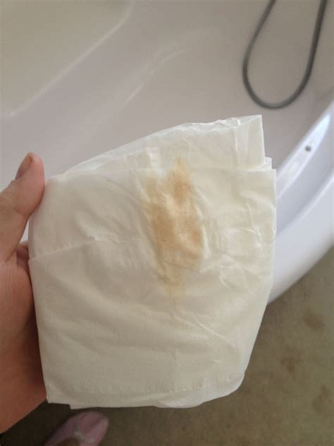 What Causes Brown Spotting Early Pregnancy at Joann Bayer blog