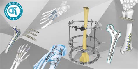 Enquiry Gate | Business Network, Grow your business, promote your ...