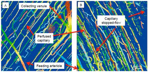 The Effect of Sepsis on the Erythrocyte