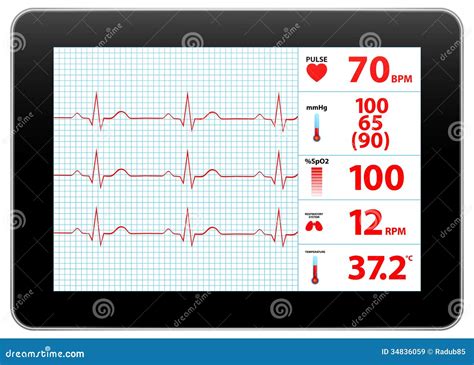 Ekg Monitor Clip Art