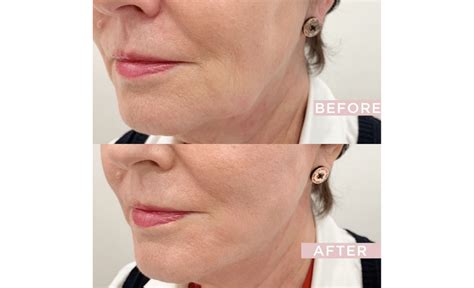 Image result for Contour Threads