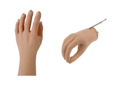 INDY Myoelectric Hand for Enhanced Functionality