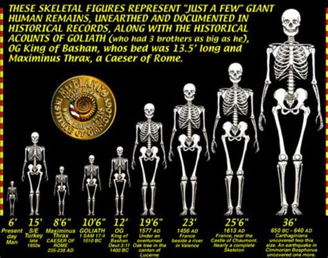 Image result for Skeleton Brain Exploding